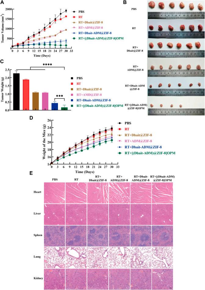 https://cdn.ncbi.nlm.nih.gov/pmc/blobs/31c9/9981937/b36e77709fd5/fbioe-11-1147064-g007.jpg