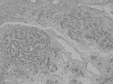https://cdn.ncbi.nlm.nih.gov/pmc/blobs/31d2/4275786/732bcc6a81e1/gr1.jpg