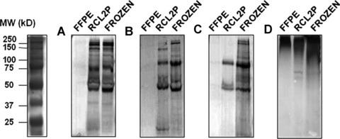 https://cdn.ncbi.nlm.nih.gov/pmc/blobs/31da/4506168/851b083e9739/jcmm0012-2027-f1.jpg