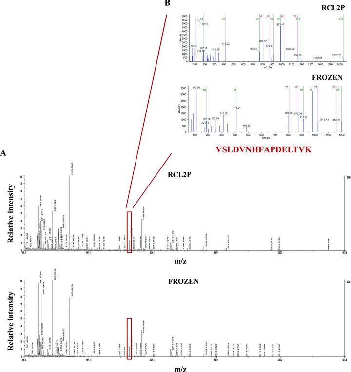 https://cdn.ncbi.nlm.nih.gov/pmc/blobs/31da/4506168/9b05d5fe384a/jcmm0012-2027-f3.jpg