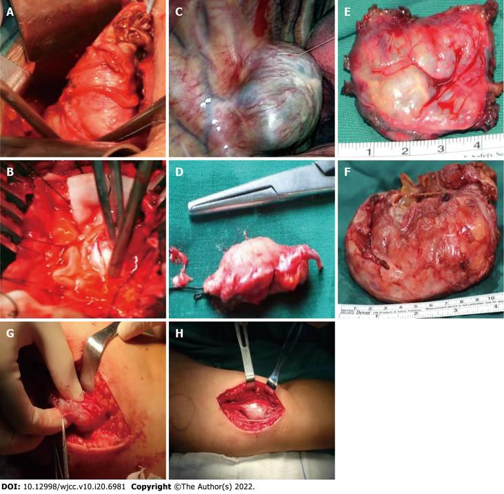 https://cdn.ncbi.nlm.nih.gov/pmc/blobs/31db/9297415/c5fd3da64800/WJCC-10-6981-g005.jpg
