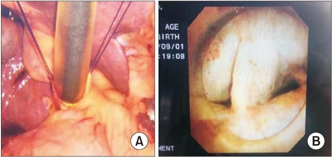 https://cdn.ncbi.nlm.nih.gov/pmc/blobs/31e6/10896692/05bcfde6535c/ahbps-28-1-42-f1.jpg