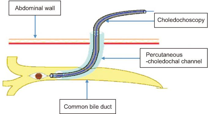 https://cdn.ncbi.nlm.nih.gov/pmc/blobs/31e6/10896692/28c6df244df3/ahbps-28-1-42-f3.jpg