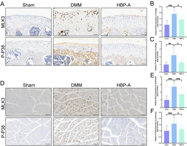 https://cdn.ncbi.nlm.nih.gov/pmc/blobs/31e6/12049151/58ebf54ef644/JCMM-29-e70577-g006.jpg