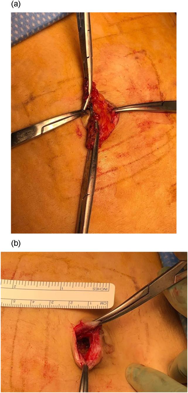 https://cdn.ncbi.nlm.nih.gov/pmc/blobs/31e8/7809397/1aad2438f15f/gr2.jpg