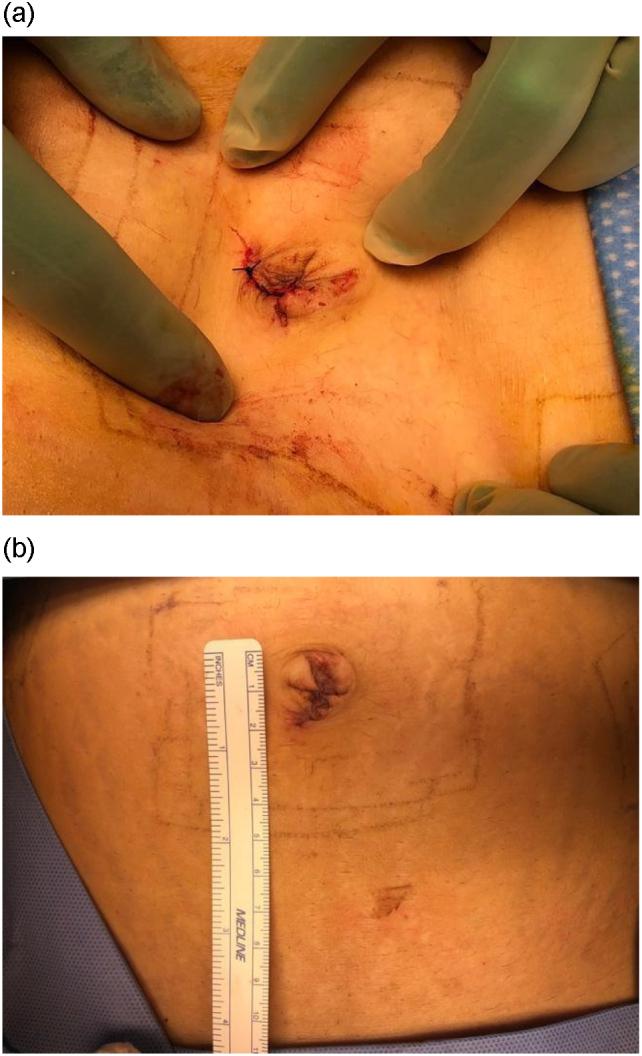https://cdn.ncbi.nlm.nih.gov/pmc/blobs/31e8/7809397/fc9ed2b311d6/gr3.jpg