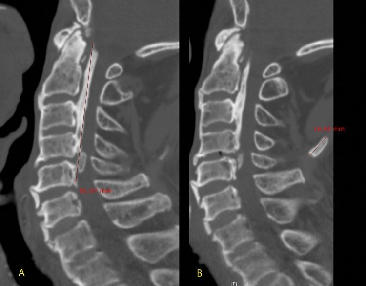 https://cdn.ncbi.nlm.nih.gov/pmc/blobs/31ea/6834259/06d4f11f4959/pone.0224729.g001.jpg