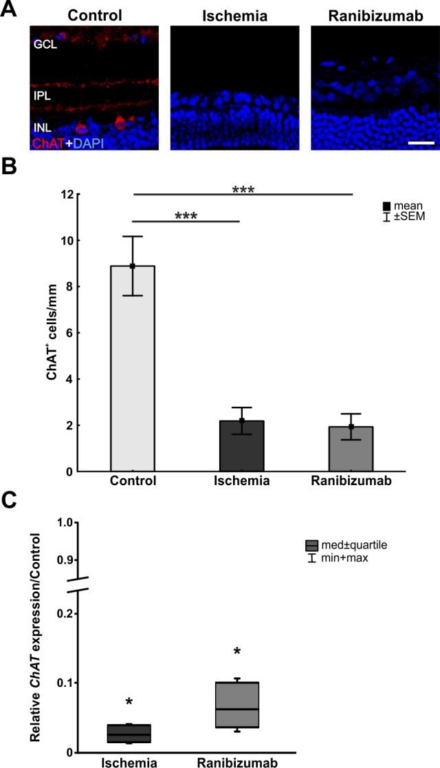 https://cdn.ncbi.nlm.nih.gov/pmc/blobs/31ec/5553852/247db5f9689c/pone.0182407.g004.jpg