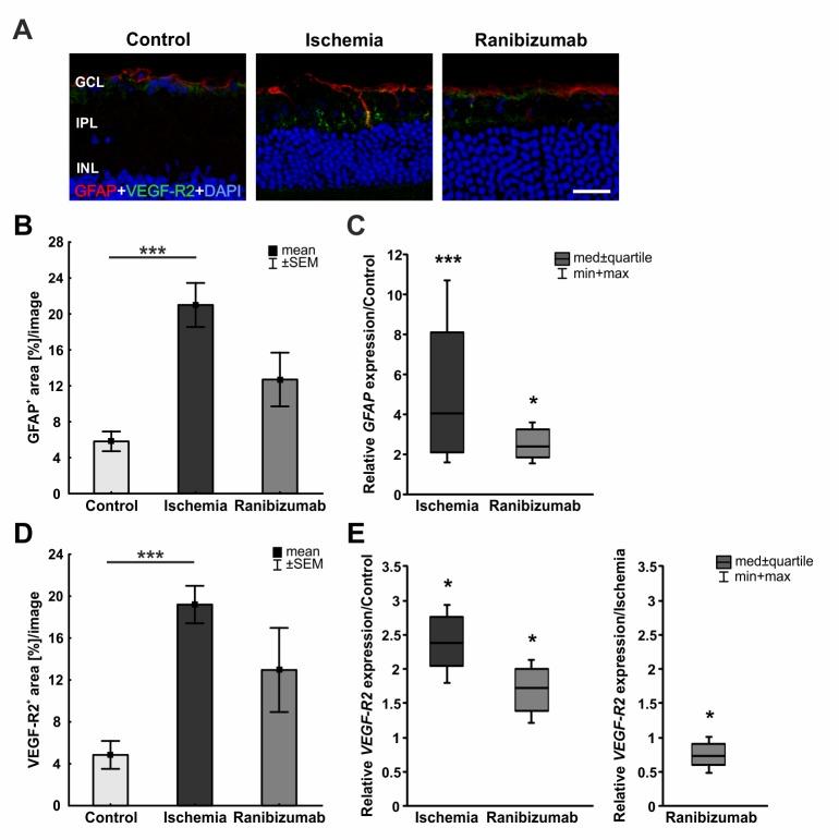 https://cdn.ncbi.nlm.nih.gov/pmc/blobs/31ec/5553852/85e8ec6ba9eb/pone.0182407.g007.jpg