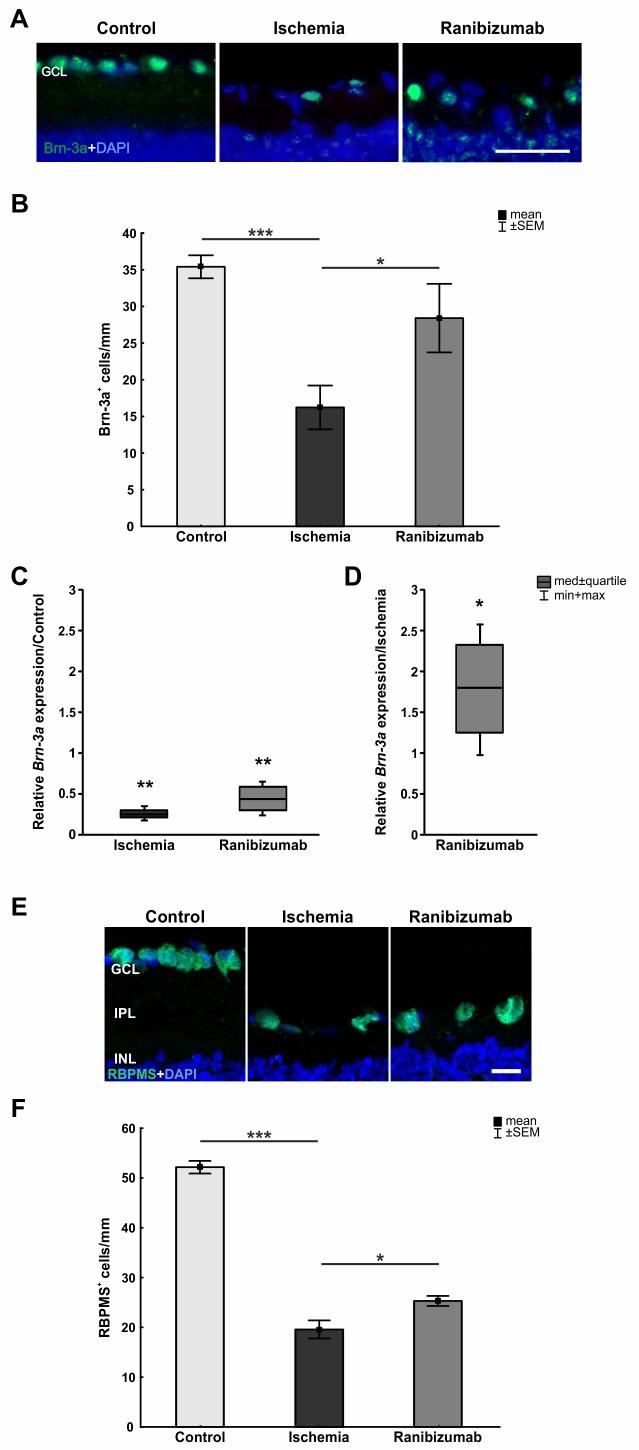 https://cdn.ncbi.nlm.nih.gov/pmc/blobs/31ec/5553852/9cdfe1302742/pone.0182407.g003.jpg