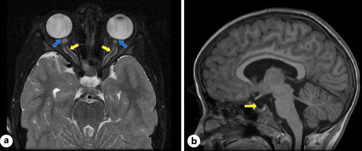 https://cdn.ncbi.nlm.nih.gov/pmc/blobs/31f0/12187110/fc388bb993e2/crn-2025-0017-0001-546097_F03.jpg