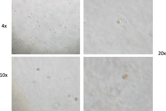https://cdn.ncbi.nlm.nih.gov/pmc/blobs/31f5/10035378/445b3727aef8/crc-22-0245_fig5.jpg