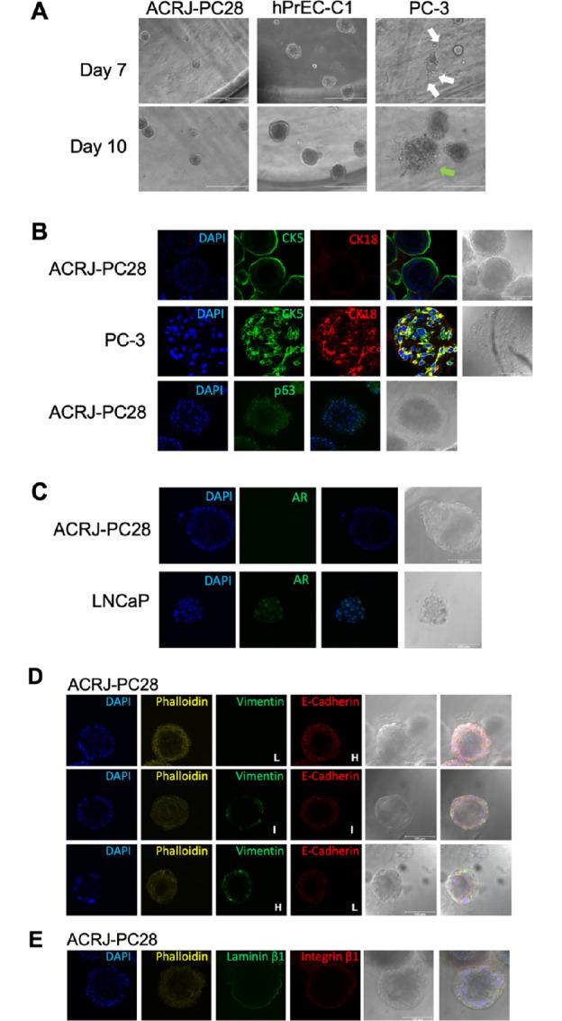 https://cdn.ncbi.nlm.nih.gov/pmc/blobs/31f5/10035378/a111baa3438d/crc-22-0245_fig6.jpg
