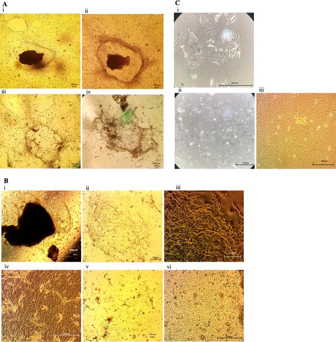 https://cdn.ncbi.nlm.nih.gov/pmc/blobs/31f5/10035378/ebb0279ab449/crc-22-0245_fig2.jpg