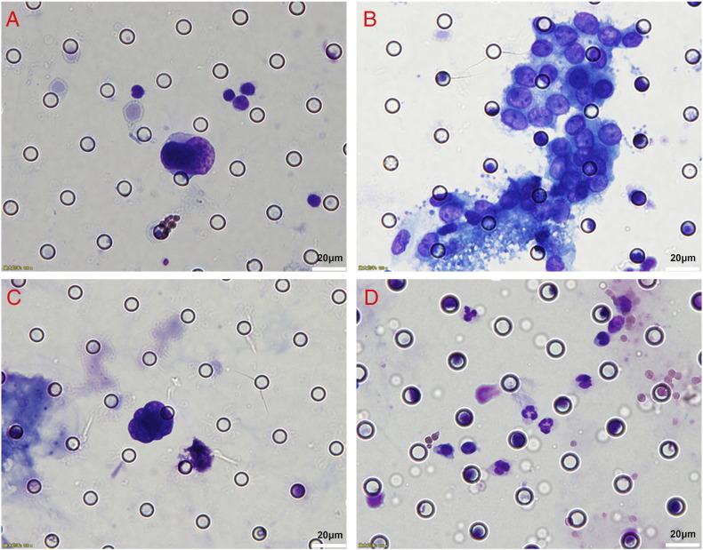 https://cdn.ncbi.nlm.nih.gov/pmc/blobs/31ff/5406582/6d5227151145/gr1.jpg