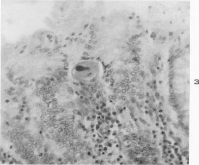 https://cdn.ncbi.nlm.nih.gov/pmc/blobs/3205/1942641/25a5c91240fe/amjpathol00694-0027-b.jpg