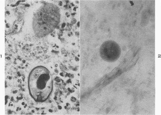 https://cdn.ncbi.nlm.nih.gov/pmc/blobs/3205/1942641/2b00ff772d21/amjpathol00694-0027-a.jpg
