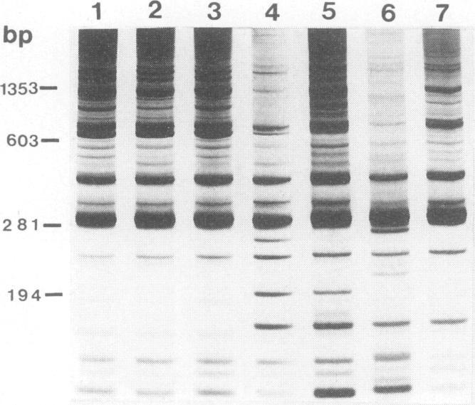 https://cdn.ncbi.nlm.nih.gov/pmc/blobs/3207/263706/0e44dc66e647/jcm00005-0252-a.jpg