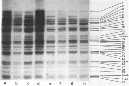 https://cdn.ncbi.nlm.nih.gov/pmc/blobs/3208/342351/72bae48dc079/nar00460-0111-a.jpg