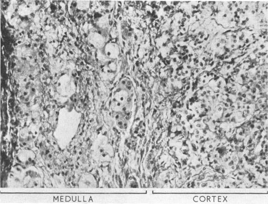 https://cdn.ncbi.nlm.nih.gov/pmc/blobs/320c/1647695/0c8589f0931e/archdisch00879-0061-a.jpg