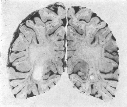 https://cdn.ncbi.nlm.nih.gov/pmc/blobs/320c/1647695/b18d35cb51fe/archdisch00879-0062-a.jpg