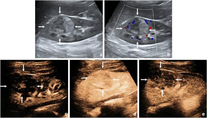 https://cdn.ncbi.nlm.nih.gov/pmc/blobs/3218/6938633/9b5057b1b4a5/40644_2019_268_Fig2_HTML.jpg