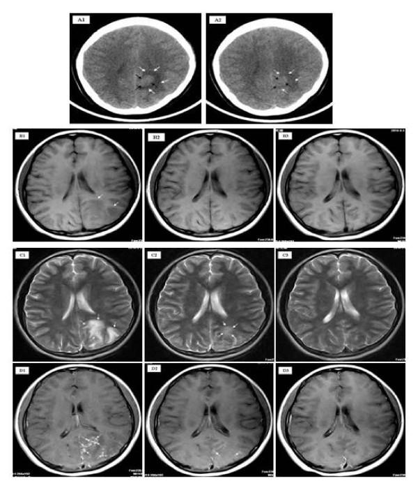 https://cdn.ncbi.nlm.nih.gov/pmc/blobs/3219/3042902/2514ae3e1c7f/1476-0711-10-5-2.jpg