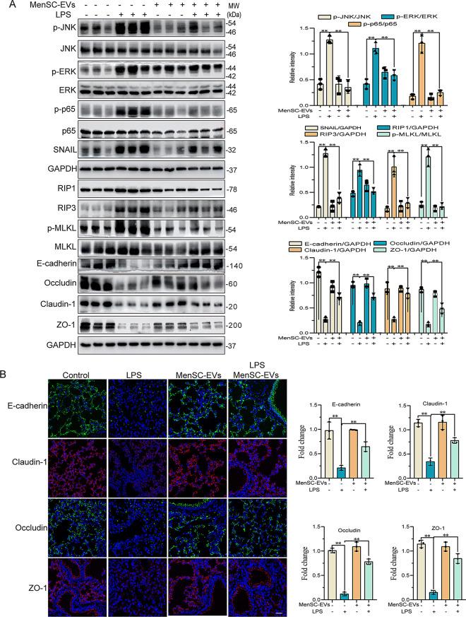 https://cdn.ncbi.nlm.nih.gov/pmc/blobs/321f/12090679/0126ed566414/13287_2025_4388_Fig6_HTML.jpg