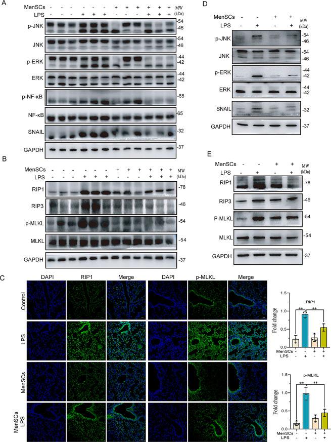 https://cdn.ncbi.nlm.nih.gov/pmc/blobs/321f/12090679/51f19b1b5abf/13287_2025_4388_Fig4_HTML.jpg