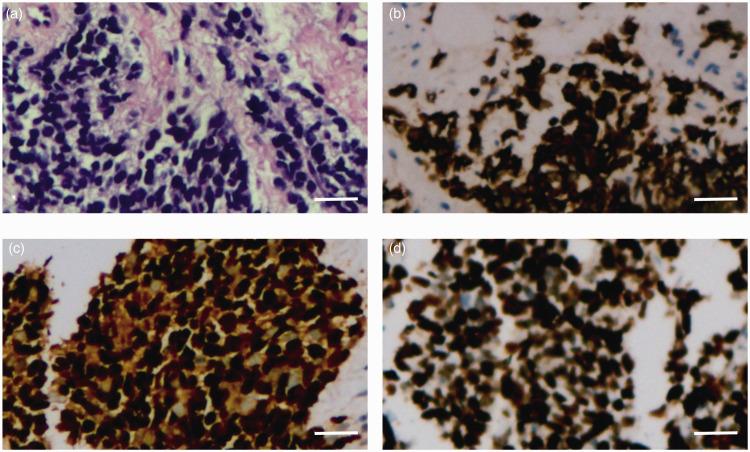 https://cdn.ncbi.nlm.nih.gov/pmc/blobs/3221/8949711/ddda208248e3/10.1177_03000605221087050-fig2.jpg
