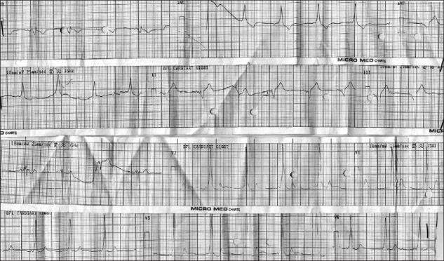 https://cdn.ncbi.nlm.nih.gov/pmc/blobs/3223/3106391/4a8325c3751a/IJA-55-167-g001.jpg