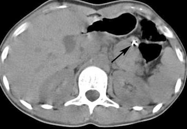https://cdn.ncbi.nlm.nih.gov/pmc/blobs/3225/2726480/49af1ed65b40/1752-1947-0003-0000006491-3.jpg
