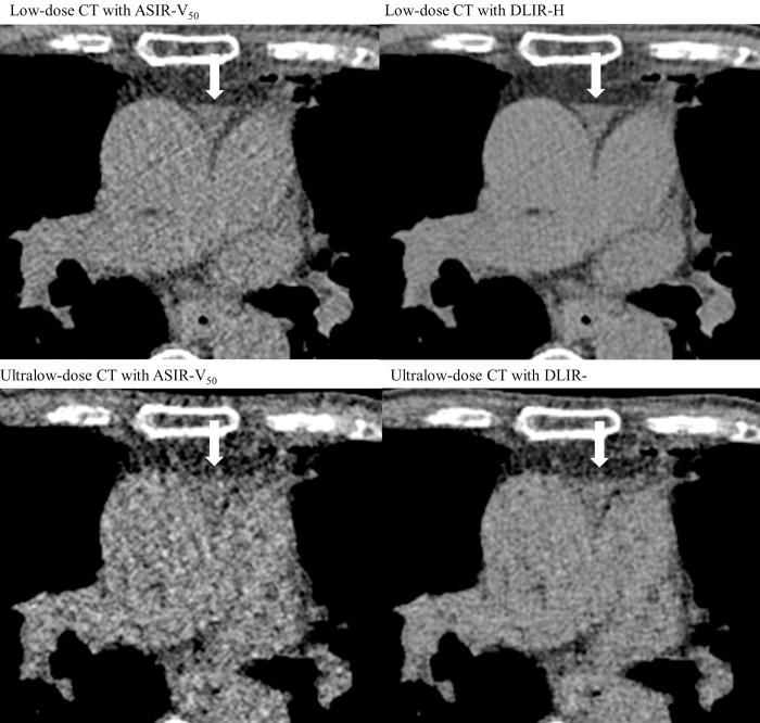 https://cdn.ncbi.nlm.nih.gov/pmc/blobs/3229/10883577/6ad4885421cb/pone.0297390.g004.jpg