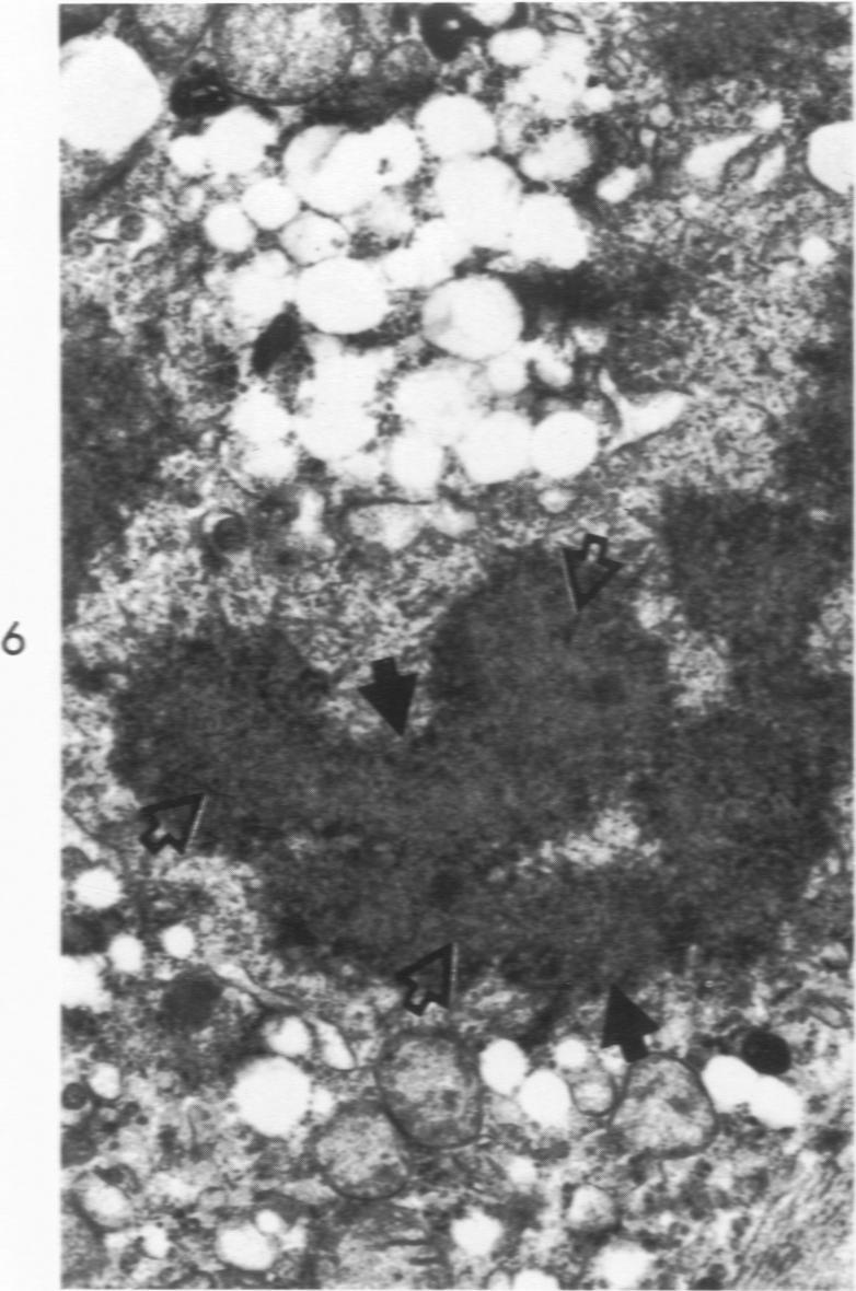 https://cdn.ncbi.nlm.nih.gov/pmc/blobs/322a/2032786/5d2134296b12/amjpathol00540-0054-a.jpg