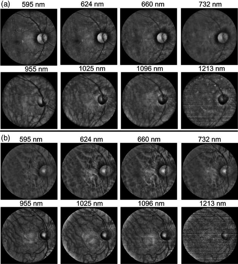 https://cdn.ncbi.nlm.nih.gov/pmc/blobs/322a/6997669/df3bba144edb/JBO-024-096007-g004.jpg