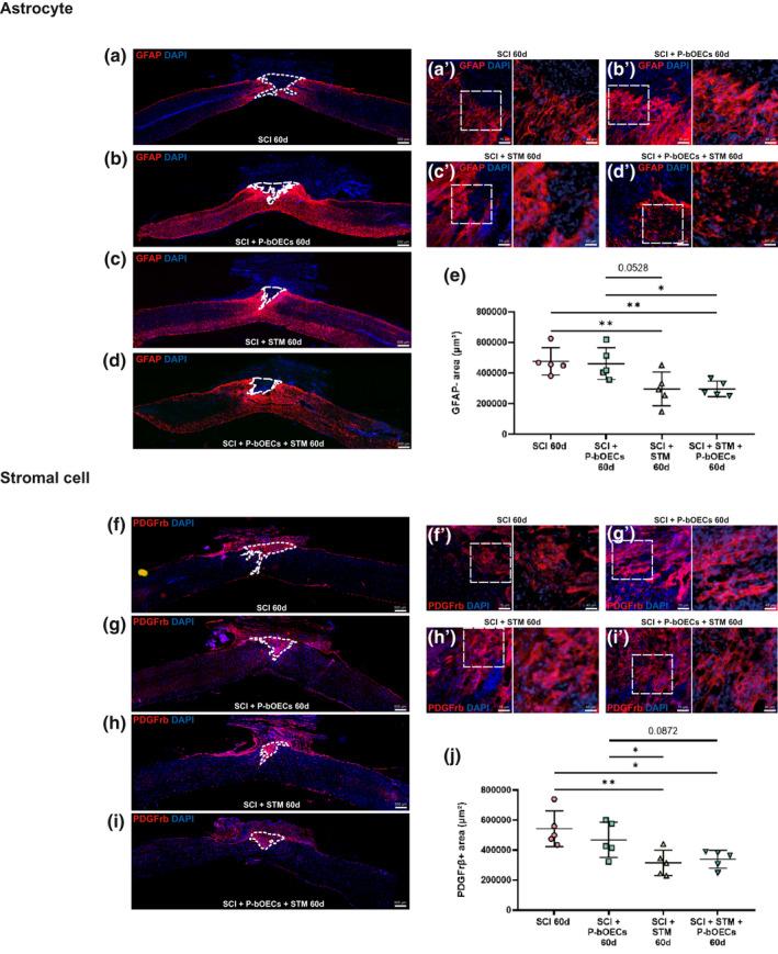 https://cdn.ncbi.nlm.nih.gov/pmc/blobs/3230/8359979/15d2a4d8b52a/JNR-99-1835-g002.jpg
