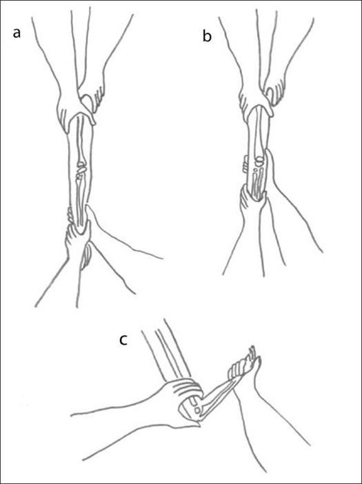 https://cdn.ncbi.nlm.nih.gov/pmc/blobs/3236/2822426/de6aca5d0e4a/IJOrtho-44-89-g001.jpg