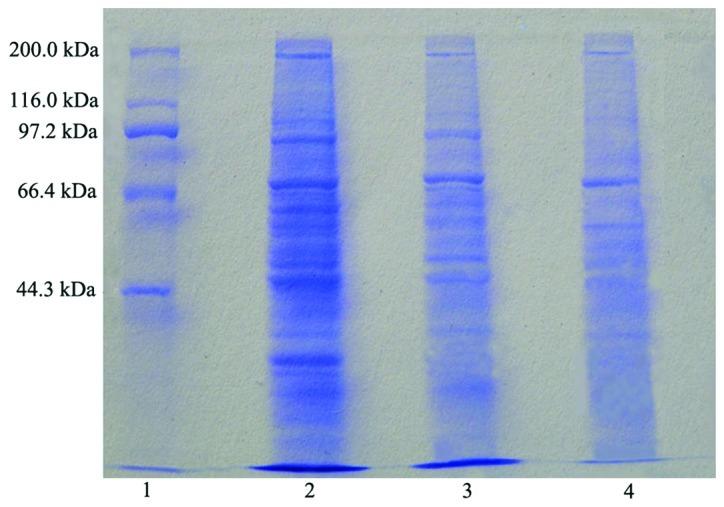 https://cdn.ncbi.nlm.nih.gov/pmc/blobs/3236/3583525/5ce5d1fffa25/OR-28-06-1977-g00.jpg
