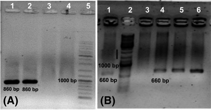 https://cdn.ncbi.nlm.nih.gov/pmc/blobs/323d/7957997/a2dd66f51822/JCLA-35-e23670-g002.jpg
