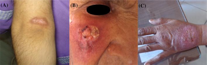 https://cdn.ncbi.nlm.nih.gov/pmc/blobs/323d/7957997/c955d8708129/JCLA-35-e23670-g001.jpg