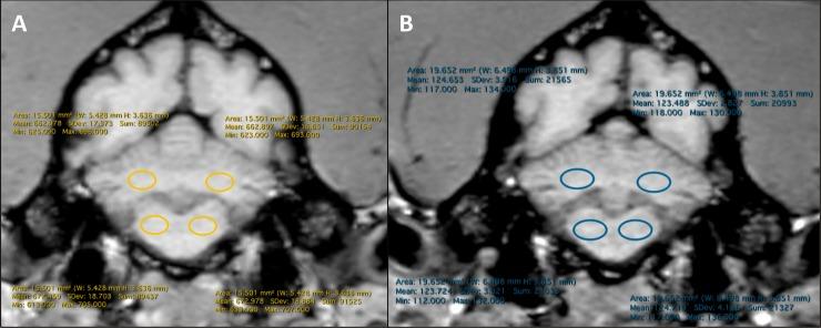 https://cdn.ncbi.nlm.nih.gov/pmc/blobs/3240/6996830/b22cfd3ccae2/pone.0227649.g001.jpg