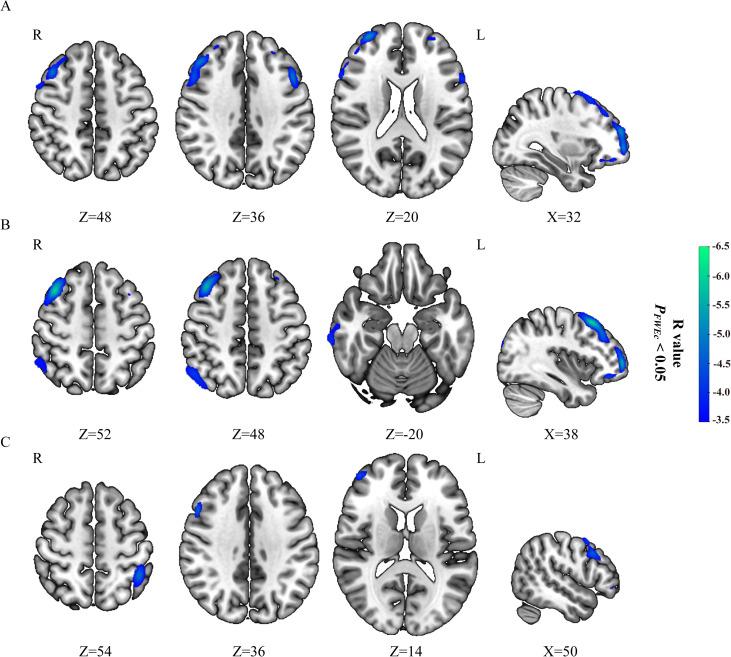 https://cdn.ncbi.nlm.nih.gov/pmc/blobs/3241/12260926/d4b33658b2fc/fonc-15-1598911-g001.jpg