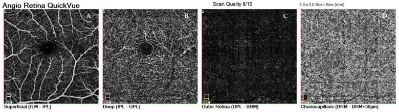 https://cdn.ncbi.nlm.nih.gov/pmc/blobs/3248/8235508/1bf3f8d9b549/jcm-10-02659-g001.jpg