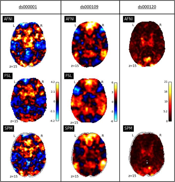 https://cdn.ncbi.nlm.nih.gov/pmc/blobs/324a/6865780/98f0f6ec2884/HBM-40-3362-g002.jpg