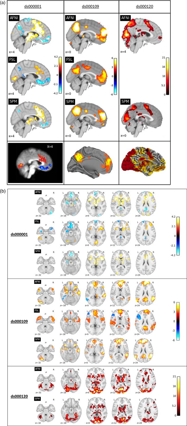 https://cdn.ncbi.nlm.nih.gov/pmc/blobs/324a/6865780/c040ba515bd1/HBM-40-3362-g001.jpg