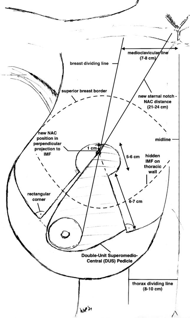 https://cdn.ncbi.nlm.nih.gov/pmc/blobs/324b/8481221/3a93fdb47412/266_2021_2351_Fig3_HTML.jpg