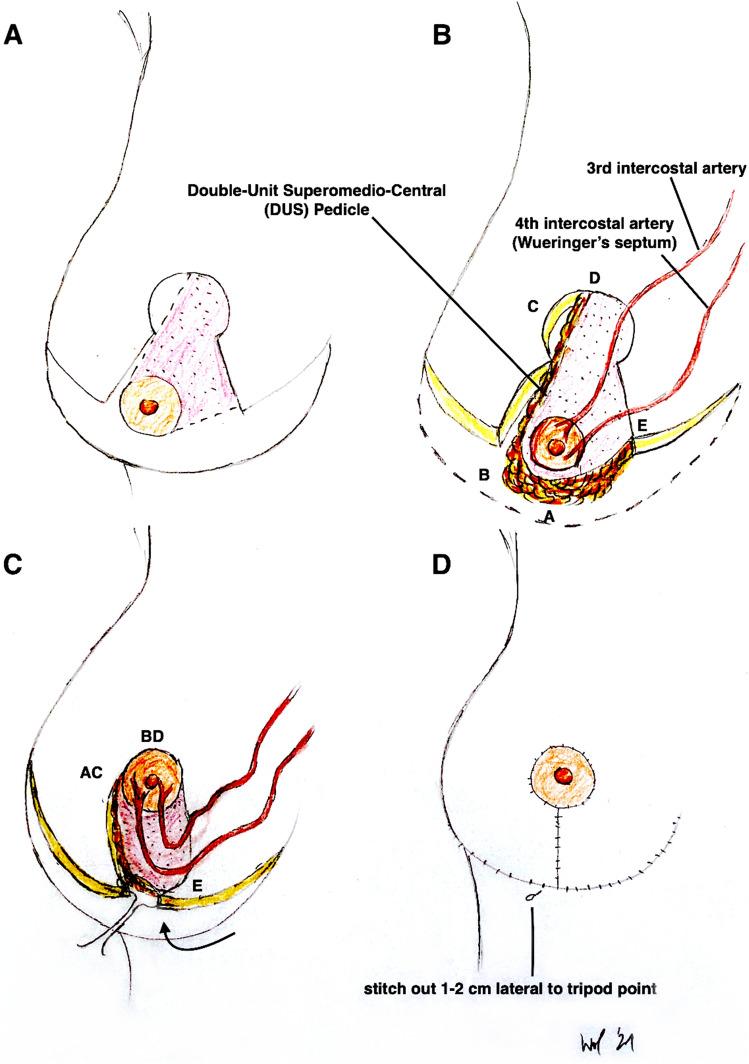 https://cdn.ncbi.nlm.nih.gov/pmc/blobs/324b/8481221/44f8a513f831/266_2021_2351_Fig4_HTML.jpg