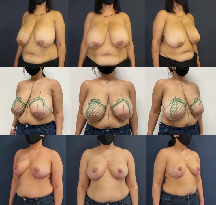 https://cdn.ncbi.nlm.nih.gov/pmc/blobs/324b/8481221/5b7c3cab617c/266_2021_2351_Fig2_HTML.jpg