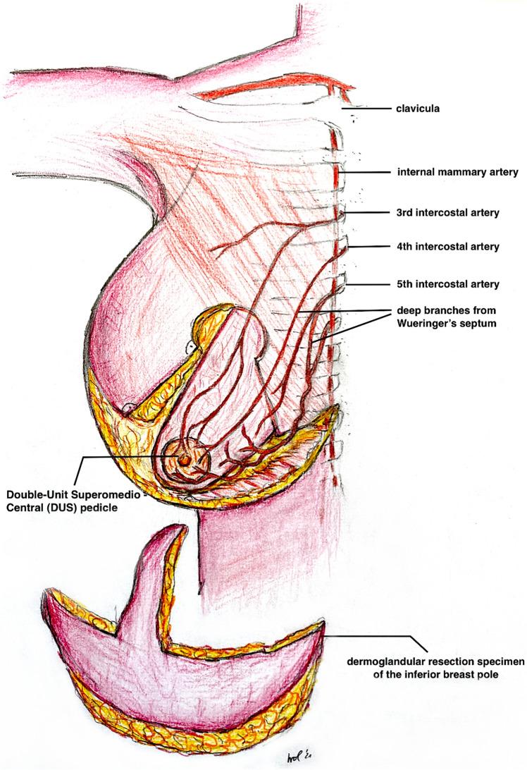 https://cdn.ncbi.nlm.nih.gov/pmc/blobs/324b/8481221/bc5b906e4c4f/266_2021_2351_Fig5_HTML.jpg