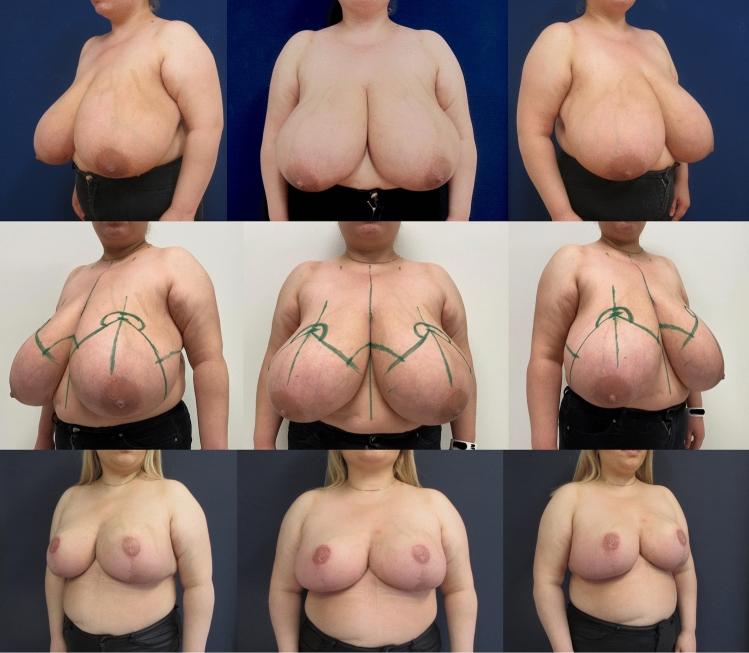 https://cdn.ncbi.nlm.nih.gov/pmc/blobs/324b/8481221/bfecd7d3f4f6/266_2021_2351_Fig8_HTML.jpg